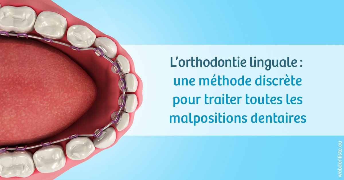 https://dr-kuetche-regille.chirurgiens-dentistes.fr/L'orthodontie linguale 1