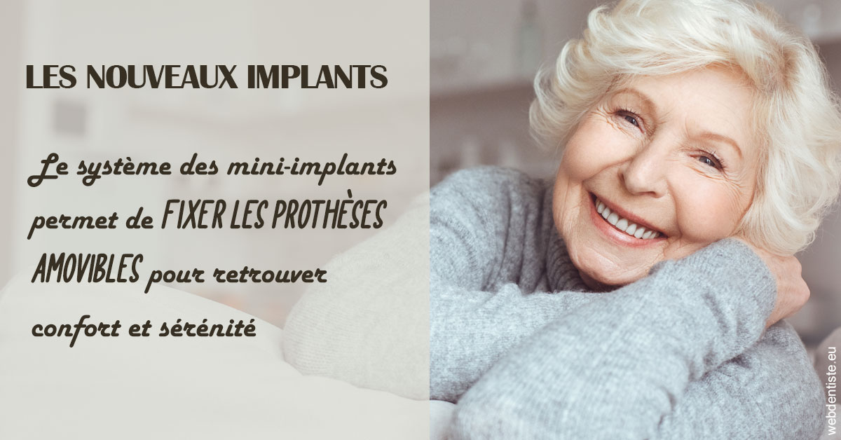https://dr-kuetche-regille.chirurgiens-dentistes.fr/Les nouveaux implants 1