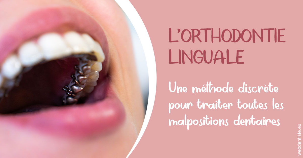 https://dr-kuetche-regille.chirurgiens-dentistes.fr/L'orthodontie linguale 2