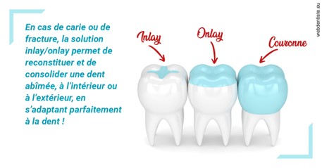 https://dr-kuetche-regille.chirurgiens-dentistes.fr/L'INLAY ou l'ONLAY