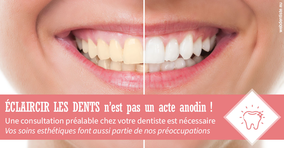 https://dr-kuetche-regille.chirurgiens-dentistes.fr/Eclaircir les dents 1
