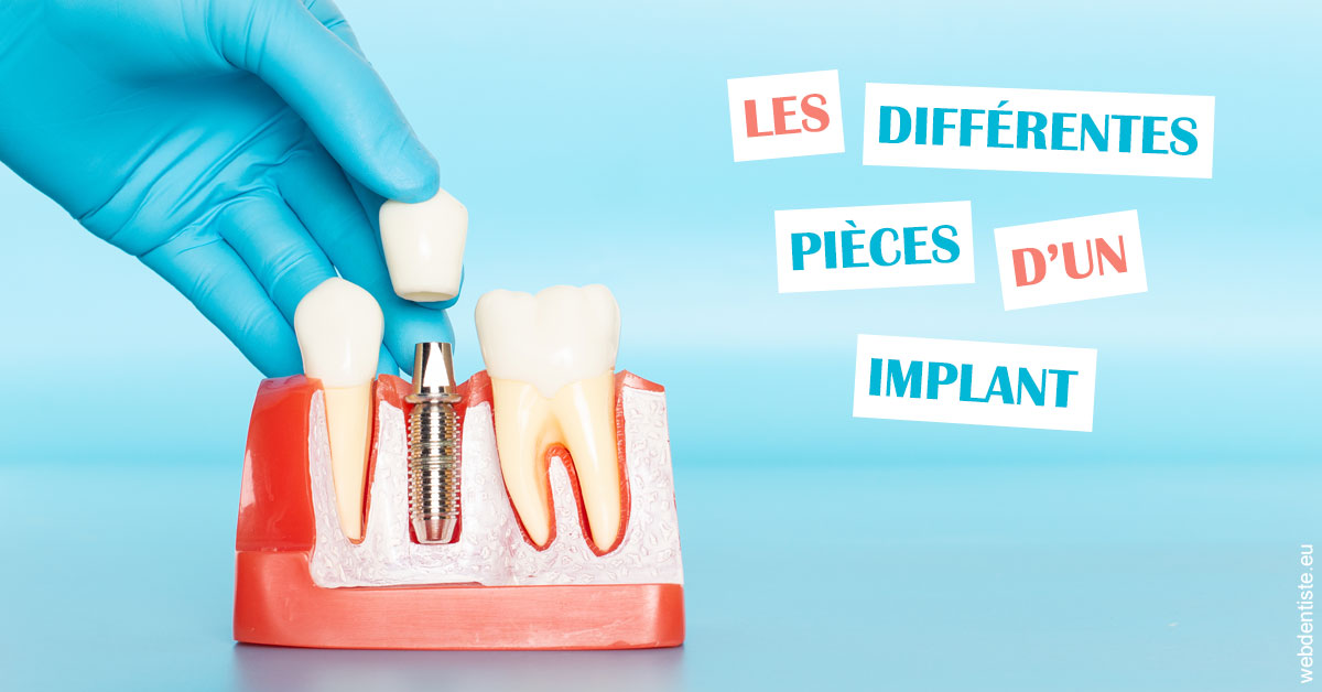 https://dr-kuetche-regille.chirurgiens-dentistes.fr/Les différentes pièces d’un implant 2