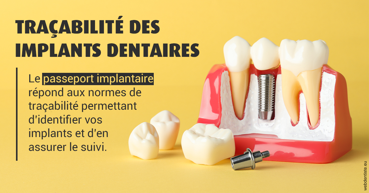 https://dr-kuetche-regille.chirurgiens-dentistes.fr/T2 2023 - Traçabilité des implants 2