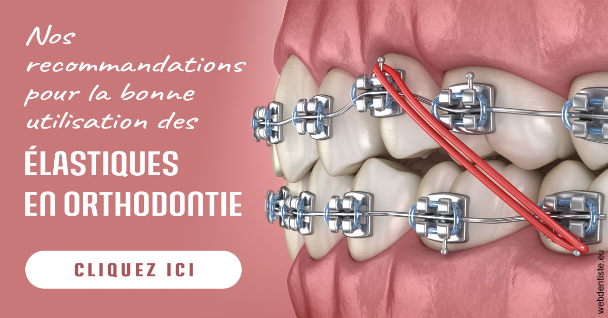 https://dr-kuetche-regille.chirurgiens-dentistes.fr/Elastiques orthodontie 2