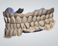 Dr-Kuetche-machoire-dentiste-complete